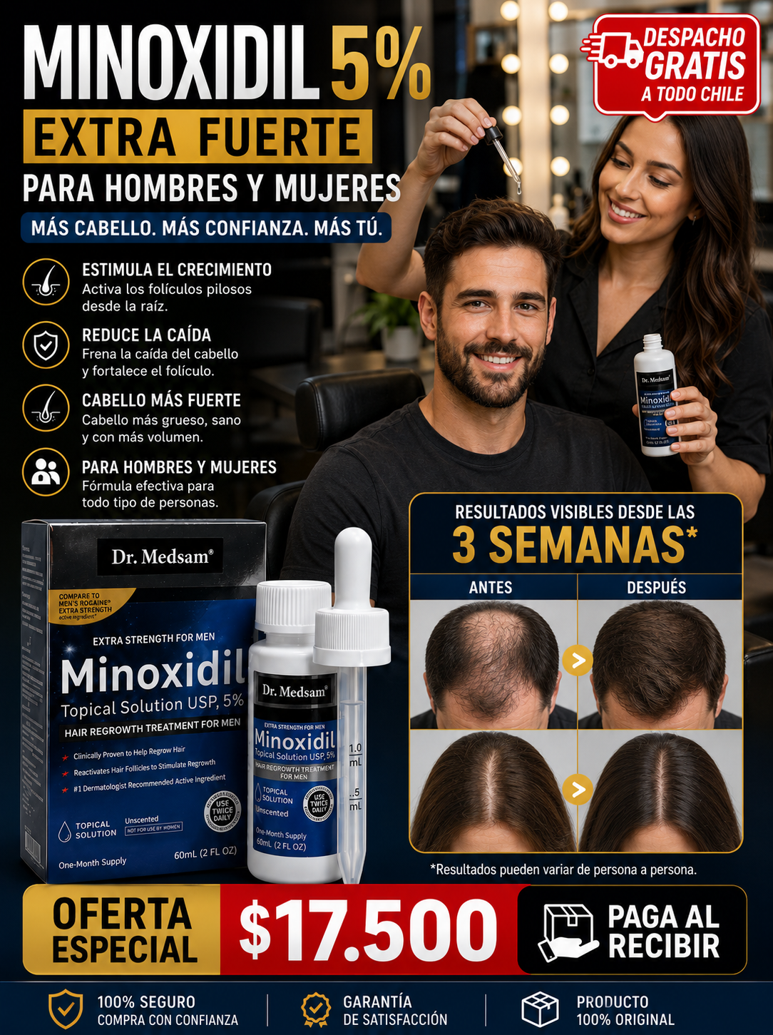Minoxidil topical 5%